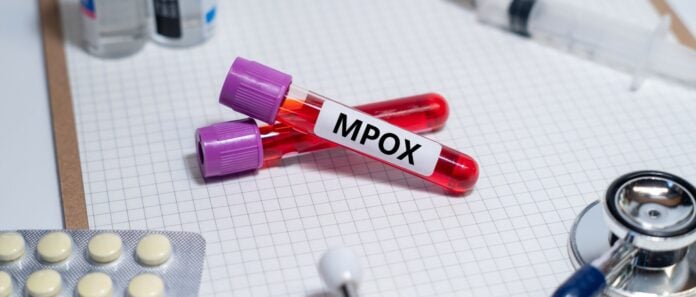 Η Σοβαρή Εξάπλωση της Mpox στην Αφρική με Συγκλονιστικά Στοιχεία και Κρούσματα